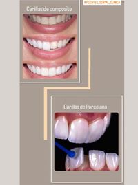 Est&eacute;tica Dental